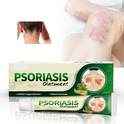 Crema Antifúngica y Antipicazón – Tratamiento Natural para Tiña, Hongos y Psoriasis