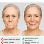 PROTESKIT™ – Prótesis Dental Completa con Soporte Esquelético (Sonrisa Firme y Natural)