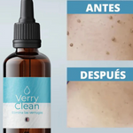 Elimina Verrugas con Verryclean+Envio Gratis