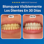 LapizDental® Nudenta Reparación Odontológica – Escudo Dental Avanzado
