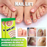 2X1 / NailLift™ - Parches para Uñas Encarnadas