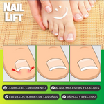 2X1 / NailLift™ - Parches para Uñas Encarnadas