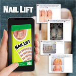 2X1 / NailLift™ - Parches para Uñas Encarnadas