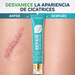 CREMA REPARADORA DE CICATRICES - ANTIGUAS Y RECIENTES, QUEMADURAS Y MÁS