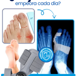 OrtoFix Pro™ Corrector de juanetes + Envío Gratis + Regalo 🎁