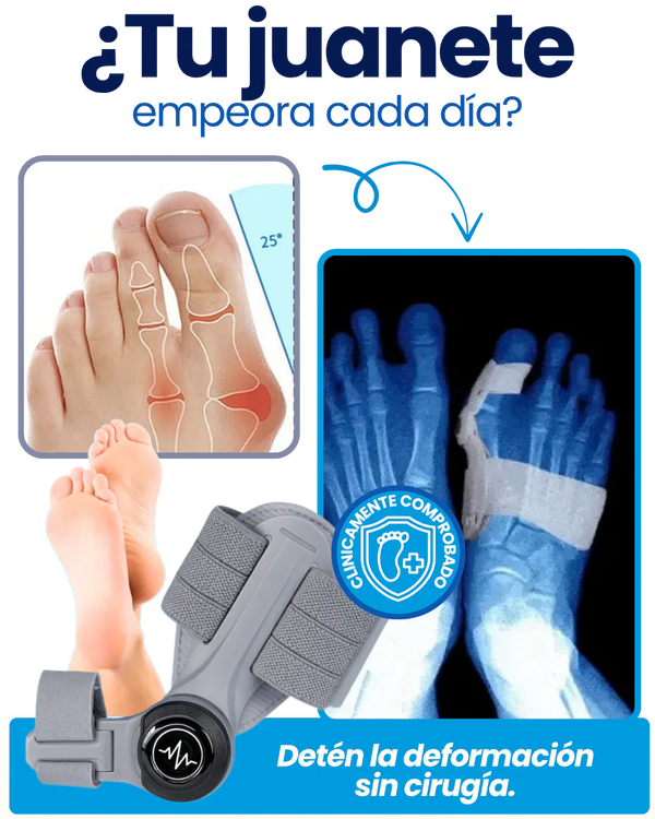 OrtoFix Pro™ Corrector de juanetes + Envío Gratis + Regalo 🎁