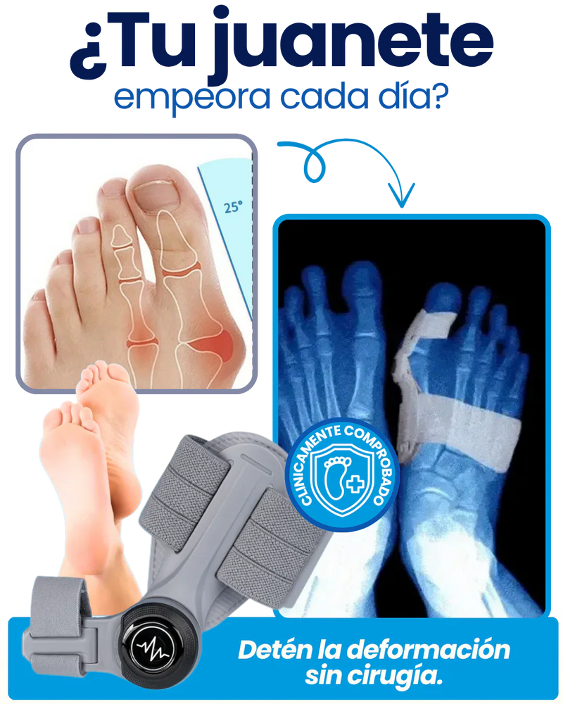 OrtoFix Pro™ Corrector de juanetes + Envío Gratis + Regalo 🎁
