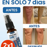 2x1 🩺 Varicose Veins™ Pro Tratamiento Intensivo Avanzado para Venas, Varices y Piernas Cansadas