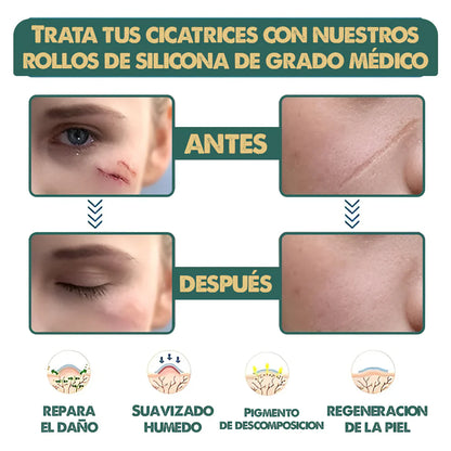 Cinta Cicatrizante , Dile adiós a las cicatrices en semanas!