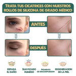 Cinta Cicatrizante , Dile adiós a las cicatrices en semanas!
