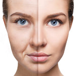 BotoxVitagold - 20 AÑOS MENOS EN 5 MINUTOS