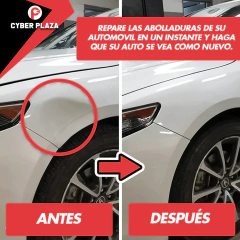 DentFix™️ - Ventosa extractor de Abolladuras para Vehículos con Envío Gratis